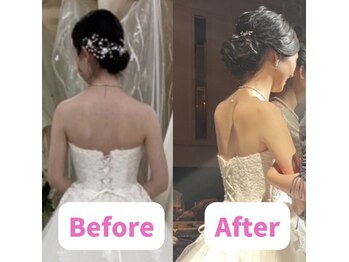 ボディキュア ブライダル美容整体 大阪梅田/【ドレス映え重視】天使の羽