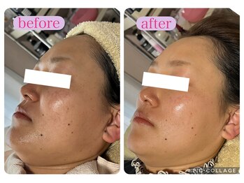 リセル(Recell)/パッと明るい素肌美人