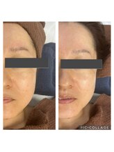 リュクス(Lux'or)/ララピール