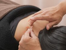 つじい鍼灸整骨院