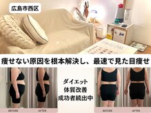 ヨサパーク シアー(YOSA PARK sheer)