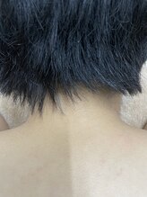 ナノハナ/鹿沼市の全身脱毛のナノハナ