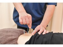 すばるはりきゅうマッサージ整骨院/鍼、腰痛、坐骨神経痛