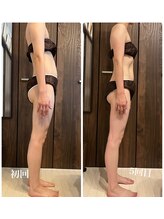 ピュア(Pure)/オールハンド筋膜リリース 