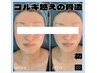 ★左右非対称・面長・エラ張り・小顔★コルギを超え骨造フェイス 6500円