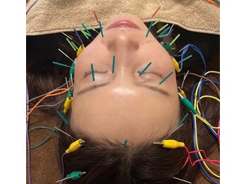 マル(malu)/美容鍼