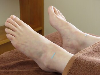 はやかわ鍼灸整骨院/自律神経・婦人科系にオススメ♪