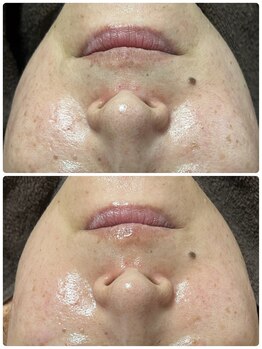 リノ(Lino)/エイジングケアも得意