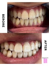 エクシアホワイトニング 王寺店/