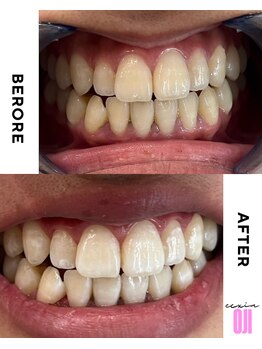 エクシアホワイトニング 王寺店/