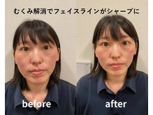 リファイン整体院 国分寺店/小顔、骨盤、ヘッドスパ、整体