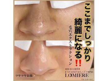 ロミエール(LOMIERE)/毛穴ケア