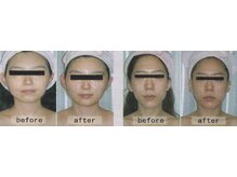 韓流美容 薬手骨気/