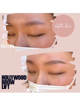 クィーンリッチ(Queen-Rich)/美眉【ハリウッドブロウリフト】