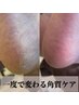 冬にカサカサ必須♪【１度で激変♪最新角質ケア】かかともツルツル★パック付