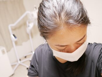 ライトビューティー 本八幡店(LIGHT BEAUTY)/薄い髪悩んでいたころの五十嵐