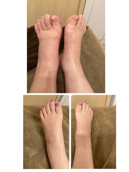 オーヴァル(Oval)/