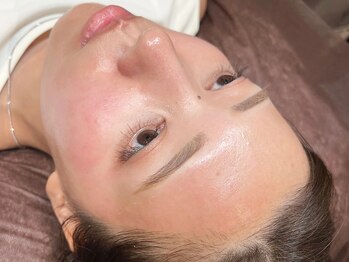 トリートマイセルフ(Treat myself)の写真/【驚きのツヤっと卵肌に】フェイシャルWAXでお顔の産毛を除去し、化粧のり・スキンケアの浸透力もUP◎