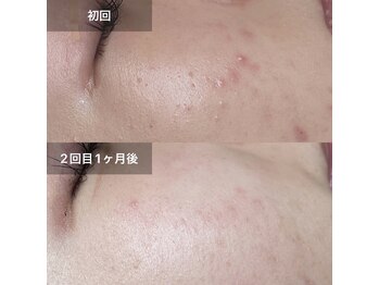 ネオオアシストウキョウ(ネオ OASIS TOKYO)/