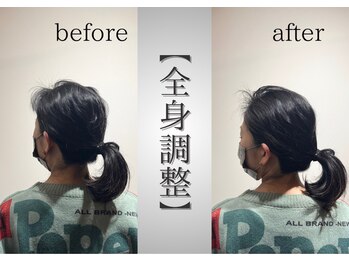 円山よもぎ鍼灸整骨院/姿勢【猫背＊頭痛＊噛み締め】