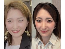 月１フェイスメソッドで不調ケアしながら垢抜け顔がつくれる