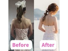 ボディキュア ブライダル美容整体 大阪梅田/【花嫁本気ケア】理想の後ろ姿に