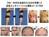 【40・50代の全身のたるみを改善◎】全身スッキリ！ハリ＆美肌コース70分