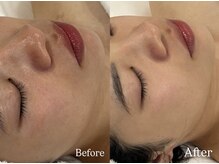 リフコウベ(LIF KOBE)/美白シミくすみ☆イラストリアス