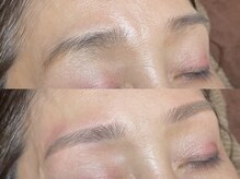 クーム(QUEUEMOU)/BeforeAfter