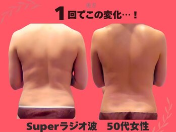 美方/見た目年齢が変わるお背中へ