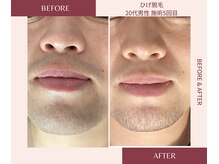 ウェルネス ステーション リンク(Wellness Station Link)の雰囲気（デザイン脱毛も◎ しっかりとヒアリングを行い、理想のおヒゲに）