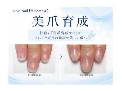 ラピスネイル(Lapis Nail)の写真