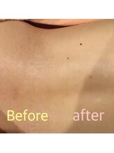 ウルル 四日市駅前店(ULULU)/施術前と施術後