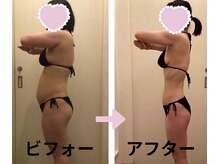 メディカルエステサロン ローズ 高岡店(ROSE)/痩身ビフォーアフター