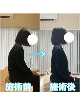 アオ 香椎(AO)/施術前→施術後