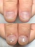 自爪育成クリア/自爪風 爪が薄い方、ダメージや形が気になる方にもオススメ♪