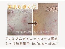 ヨサパーク クレール 東札幌店(yosa park claire)/お肌も魅せる肌に変わる☆
