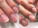爪悩みの２枚爪も即日補強できる