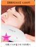 【お顔のうぶ毛をなくし化粧ノリUPの美肌に】レディース顔脱毛1回 30分4400円