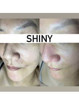 シャイニー(SHINY)/30代女性