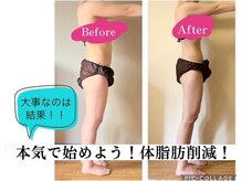 代謝UP・痩身.・美肌！キレイが叶う◎脱リバウンド！
