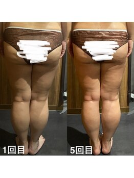 サンナナヨンプラス(374+)/【ハイパーナイフ×シェイプ】