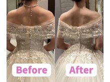 ボディキュア ブライダル美容整体 大阪梅田/【肩の盛り上がり解消】花嫁美容