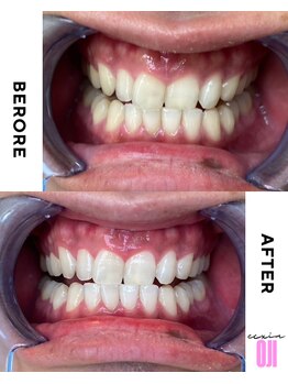 エクシアホワイトニング 王寺店/