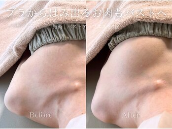 エメ(Aimee)/バストアップエステ