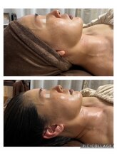 リボーン(be reborn)/たっぷりの栄養をお肌へ