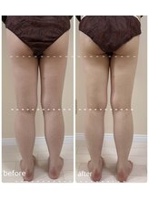 リミュール(Ri.miyuru)/下半身リンパマッサージ