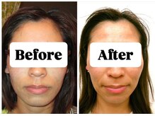 マンマ ジュンナ/【浜松/小顔/小顔矯正】