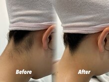 クイーン 渋谷店(QUEEN)/みんなのためのうなじケア