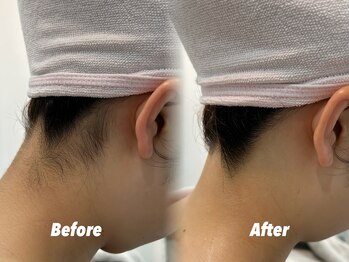 クイーン 渋谷店(QUEEN)/みんなのためのうなじケア